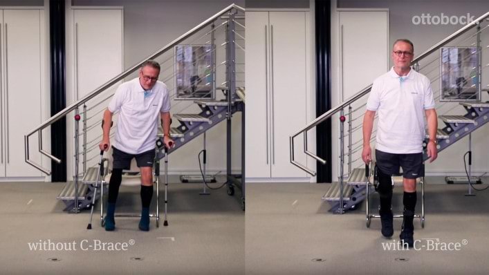 Gait Cycle Comparison C-Brace vs. no orthosis